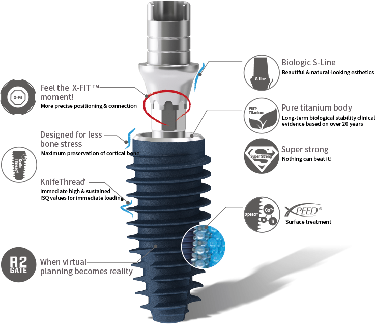 Implant dentar performant Galați - clinica IMPLANTOART