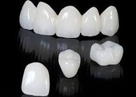 implant dentar galati, implantologie galati, dinti zirconiu, implantoart