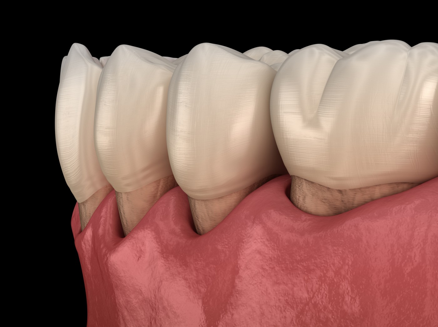 Chirurgie dentară IMPLANTOART